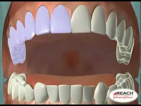 Vídeo: O que é o teste TEAS para higiene dental?