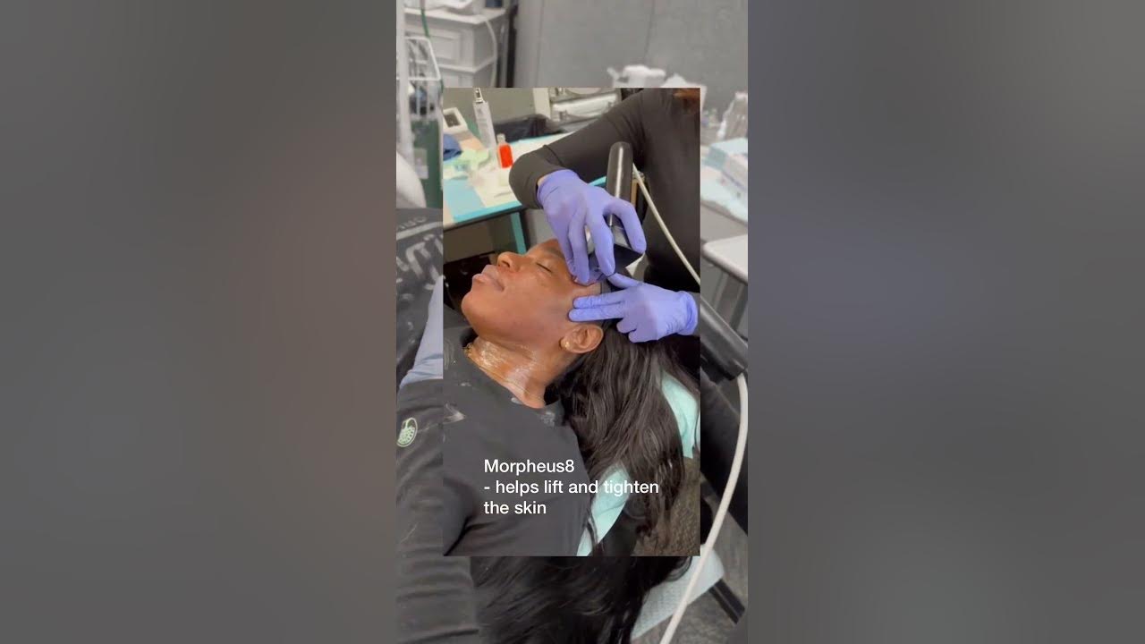 How Do I Get Rid Of Deep Pores On My Nose Skin Tightening Treatment how-do-i-get-rid-of-deep-pores-on-my-nose-skin-tightening-treatment