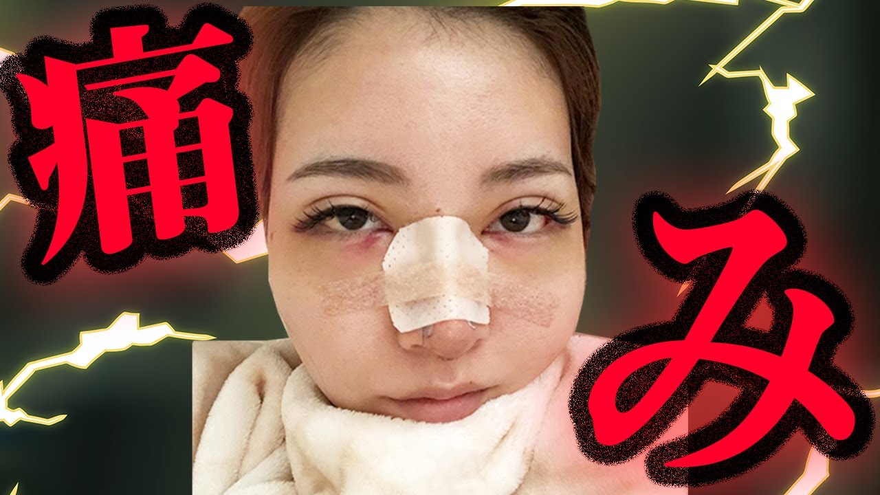 激痛 整形の痛み どれくらい続くか知っていますか Youtube