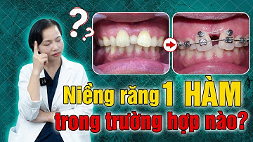 Niềng Răng 1 Hàm Có Được Không?