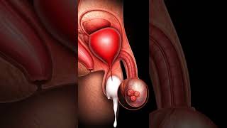 A inflammation in the testicle #health #animation #usa