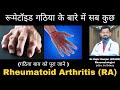         all about rheumatoid arthritis ra