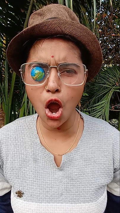 My Eyeball Came Out! 😱 A Shocking and Unbelievable Experience!😳 #EyeballIncident#shorts