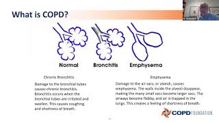 The Latest in COPD Diagnosis & Treatment Options Beyond Medications, an educational webinar