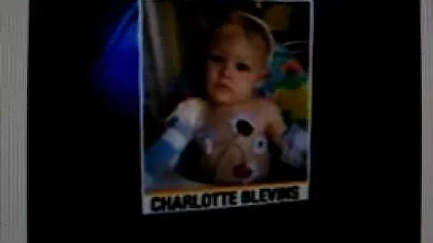Pit bull attacks 15-month-old Charlotte Blevins