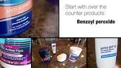 Adult Acne - Mayo Clinic