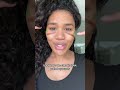 here’s how we can treat the line in the deep cheek #asymmetricface #naturalfiller #blackgirlluxury