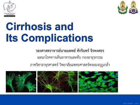 วีดีโอ: Hemochromatosis: อาการ การรักษา และการพยากรณ์โรค