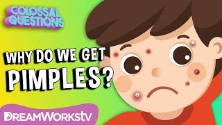 Why Do We Get Pimples? | COLOSSAL QUESTIONS