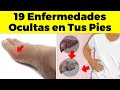 ¡ALERTA! Descubre las 19 Señales de Enfermedad en Tus Pies