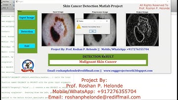 Skin Cancer Detection Matlab Code | Skin Cancer Detection Using Image Processing With Source Code