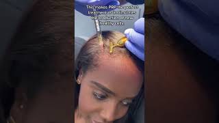 PRP Hair therapy for hair loss | Dr. Medispa PRP Hair therapy for hair loss | Dr. Medispa