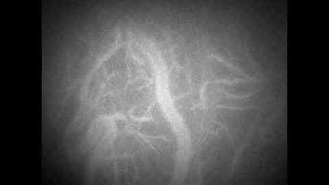 Real-time laser Doppler imaging of the retina by ultra-fast GPU rendering of holograms