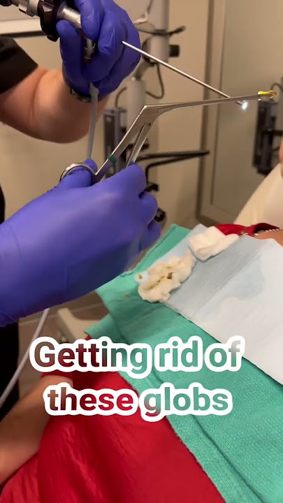 You won't believe what comes out of this patient's nose!