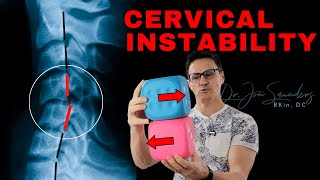 Cervical Instability: What You Should Know | Dr. Jon Saunders