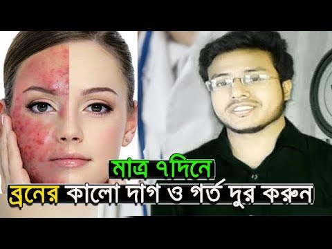 ভিডিও: কীভাবে জিনসে গর্ত তৈরি করবেন