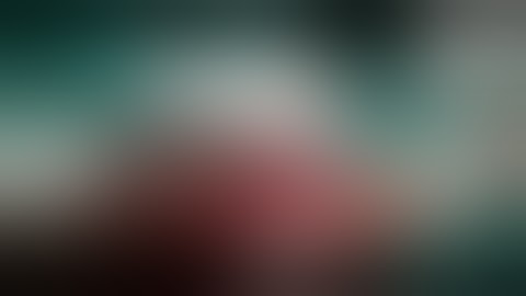 Ilizarov fixation of Infected non union of Femur