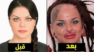 اغرب عمليات التجميل التي انتهت بالفشل 