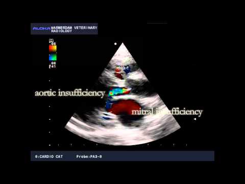 Video: Echocardiografische Beoordeling Van Ischemische Mitrale Regurgitatie