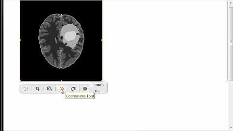 Estimation of the fractal dimension of an MRI tumor volume using 3D box counting