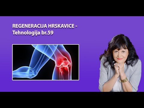 Video: Zglobna Hrskavica I Promjene U Artritisu: Stanična Biologija Osteoartritisa