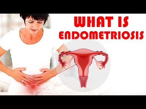 What is Endometriosis ? | #Endometriosis Causes, Symptoms and Treatments | Womens Health