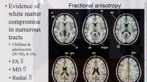 fMRI approaches to network connectivity in autism spectrum disorders