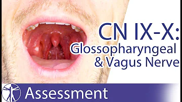 Cranial Nerve 9 & 10 | Glossopharyngeal & Vagus Nerve Assessment for Physiotherapists