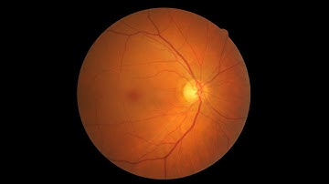 Detect eye disease using Artificial Intelligence (step by step demo)