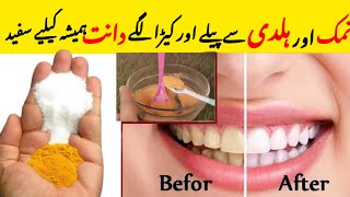 Danto Ko Safed Kaise karain||Teeth Whitening At Home||Teeth Whitening Home Remedy