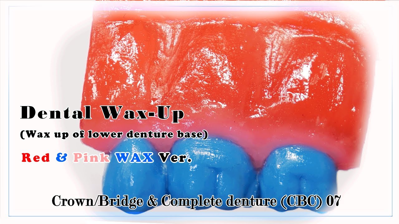Dental Waxup For Crown/Bridge & Complete denture(CBC) Wax up of Lower