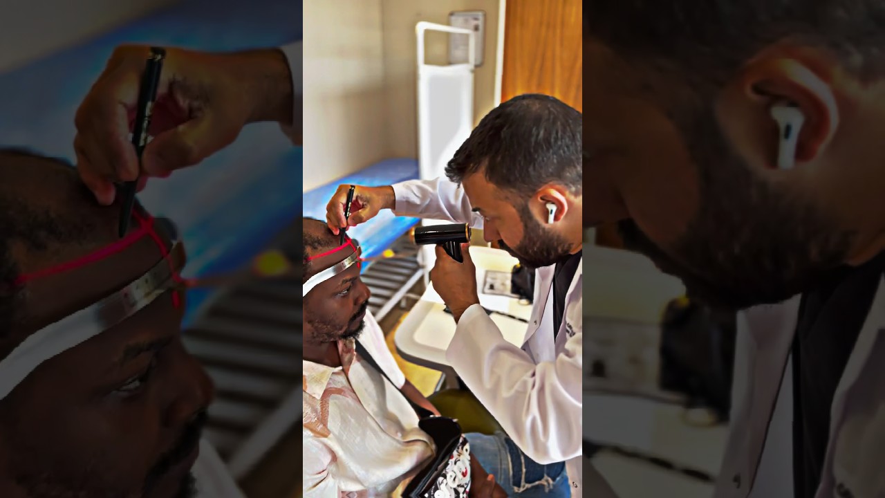 Best Hair Transplant Surgeon