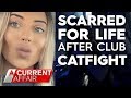 Club catfight leaves woman scarred for life | A Current Affair