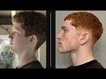 How i improved my face and jawline look better now