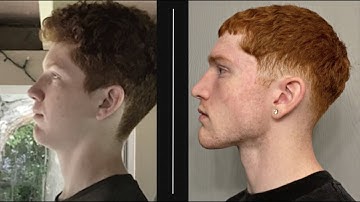 How I Improved My Face and Jawline (Look Better Now!)