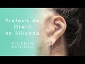 Prótesis estética para Oreja - Pabellón auricular Silskin Argentina