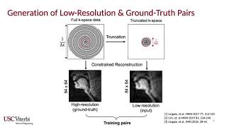 Prakash Kumar | Feasibility of Super Resolution Speech RT-MRI using Deep Learning