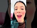 Depois do preenchimento labial sempre fica inchado, o resultado vem depois de uma semana