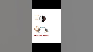 Angle Depth Assessment |Torch light Method #ophthalmology