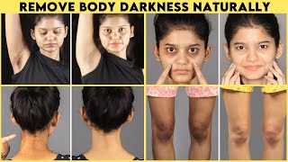 Get Rid of BODY DARKNESS Naturally | Dark Circles/Dark Underarms/Dark Neck/Dark Elbow REMEDY |