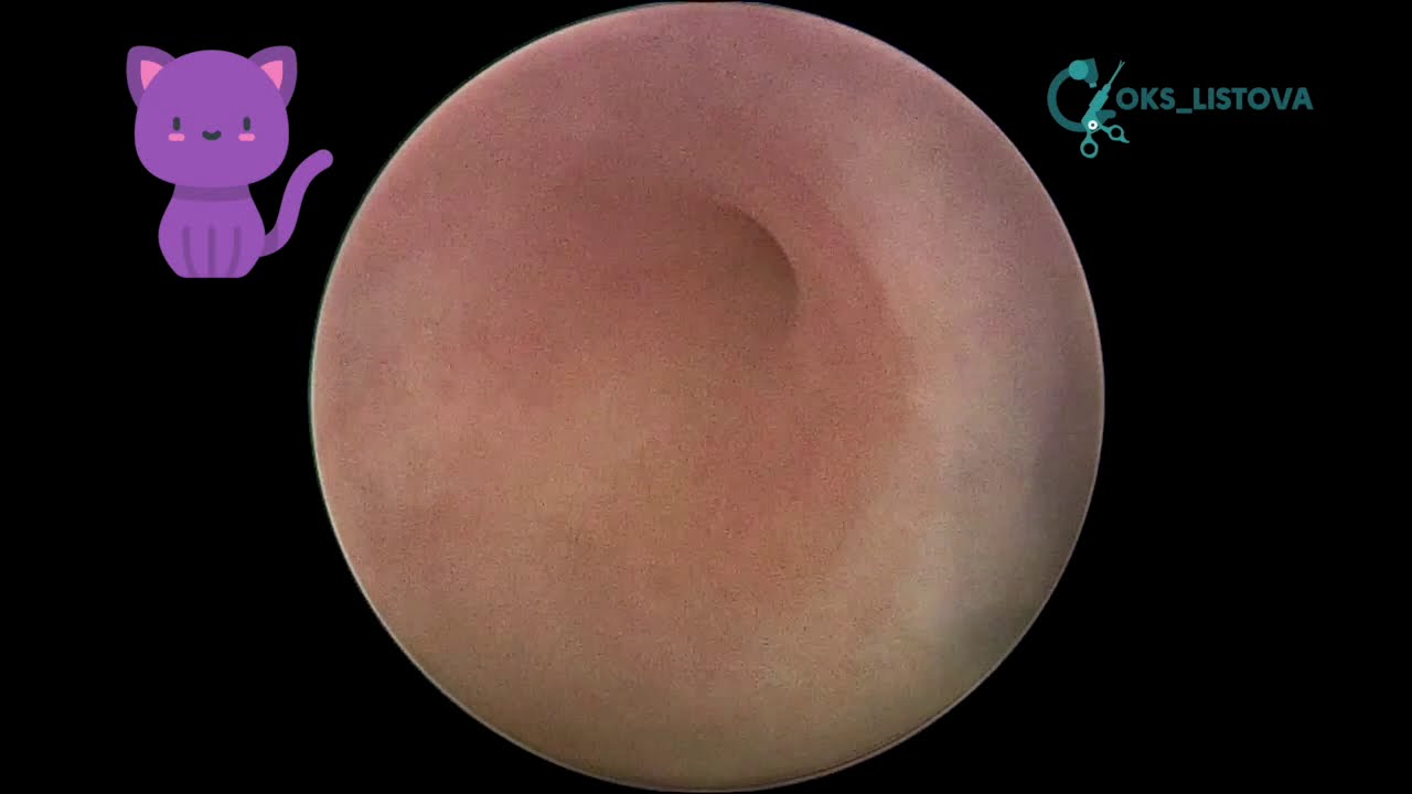 Image showcasing Feline Interstitial cystitis / Интерстициальный цистит кошек - YouTube