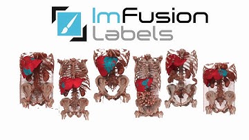 ImFusion Labels - Coming Soon