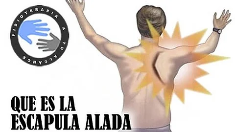 ¿Qué pasa cuando duele el omóplato?