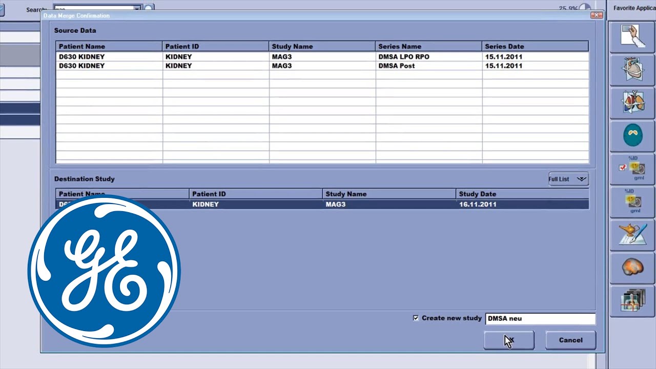 mrid дикий яд ремикс Xeleris 4 MI Workstation Merge Tool - Zusammenführen von Datensätzen