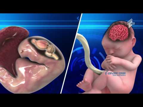 ზიკა ვირუსი - მეცნიერები ახალ კვლევებს აქვეყნებენ