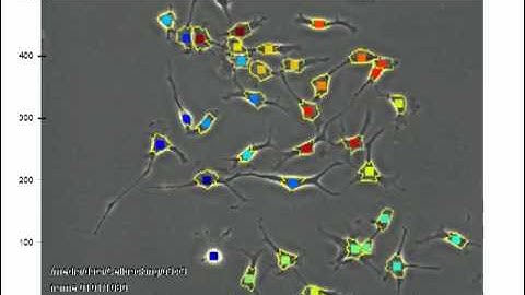 automatic cell tracking (phase contrast microscopy)