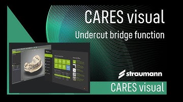 Undercut Bridge Function