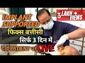 फिक्स बत्तीसी सिर्फ 3 दिन में LIVE / IMPLANT FIX DENTURE