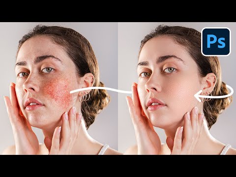 ERASE Blotchy Skin with High-End Retouching Trick! - Photoshop Tutorial