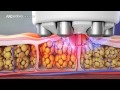 Medical device 3d animation showreel  arcreative media
